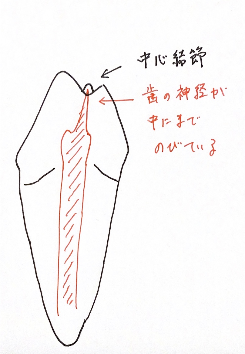 中心結節破折の予防について