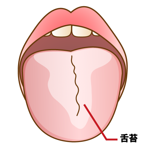 舌を綺麗に保つには？
