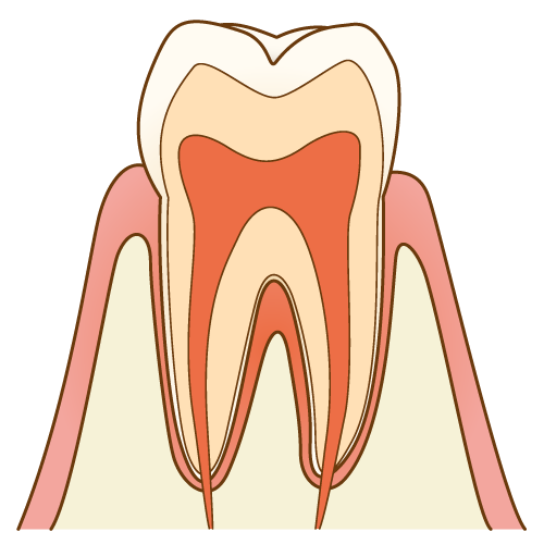 左京区　歯医者　金田歯科医院 歯の中には神経と血管の管