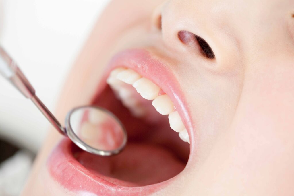 歯の治療を受ける女性の口元