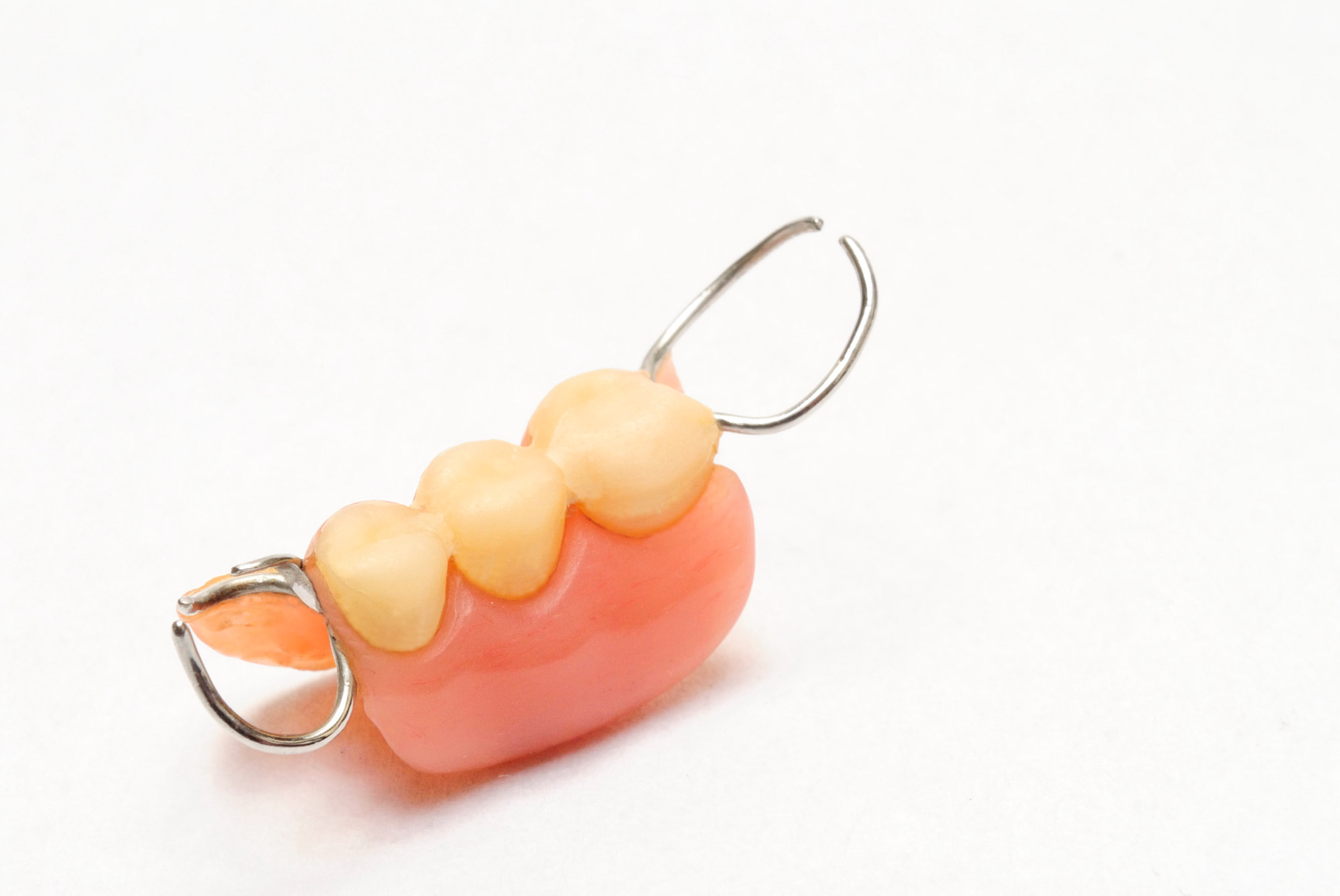 人工歯の不自然な色と固定する金属バネが目立つ入れ歯